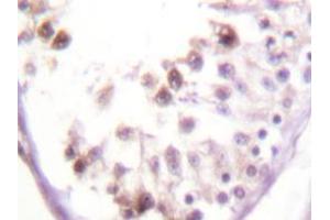 Immunohistochemistry analyzes of HDAC6 antibody in paraffin-embedded human testis tissue. (HDAC6 抗体)