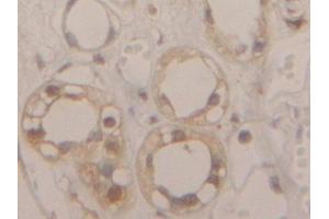 Immunohistochemistry (IHC) image for anti-Glyceraldehyde-3-Phosphate Dehydrogenase (GAPDH) (AA 154-324) antibody (ABIN7438157)