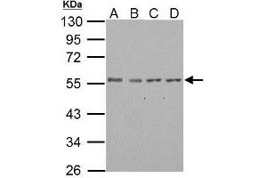 WB Image IP6K1 antibody detects IP6K1 protein by western blot analysis. (IP6K1 抗体)