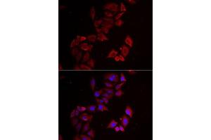 Immunofluorescence analysis of MCF7 cells using LIMS1 antibody (ABIN6132049, ABIN6143233, ABIN6143235 and ABIN6222007). (LIMS1 抗体  (AA 1-325))