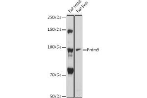 Western blot analysis of extracts of various cell lines, using Prdm9 antibody (ABIN7269502) at 1:1000 dilution. (PRDM9 抗体)