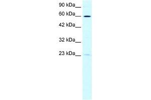 WB Suggested Anti-SUPT3H Antibody Titration: 0. (SUPT3H/SPT3 抗体  (N-Term))