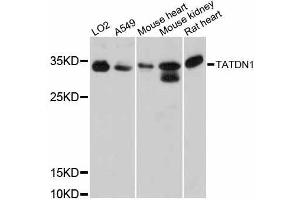 Western blot analysis of extracts of various cell lines, using TATDN1 antibody (ABIN5999010) at 1:3000 dilution. (TATDN1 抗体)