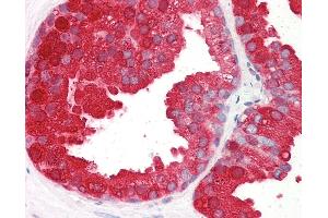 Anti-ACPP antibody IHC of human prostate. (ACPP 抗体  (AA 269-282))