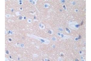 #VALUE! (Protein Phosphatase 3, Regulatory Subunit 1 (AA 2-170) 抗体)