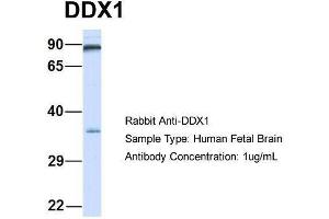 Host:  Rabbit  Target Name:  DDX1  Sample Type:  Human Fetal Brain  Antibody Dilution:  1. (DDX1 抗体  (Middle Region))