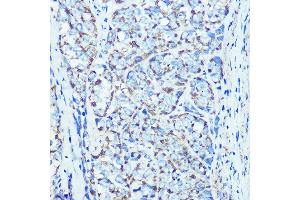 Immunohistochemistry (IHC) image for anti-ATP Synthase, H+ Transporting, Mitochondrial F1 Complex, beta Polypeptide (ATP5B) antibody (ABIN7265722)