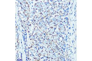 Immunohistochemistry of paraffin-embedded rat kidney using ATPB Rabbit mAb (ABIN7265722) at dilution of 1:100 (40x lens). (ATP5B 抗体)