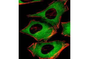 Immunofluorescence (IF) image for anti-Phosphatidylinositol-5-Phosphate 4-Kinase, Type II, alpha (PIP4K2A) (AA 329-363), (C-Term) antibody (ABIN6243276)