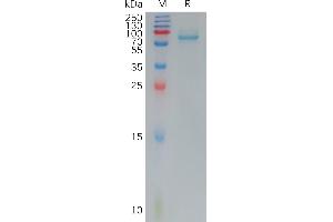 Human Protein, hFc Tag on SDS-PAGE under reducing condition. (FZD7 Protein (Fc Tag))