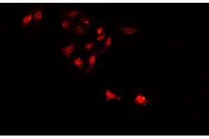 ABIN6268997 staining A549 cells by IF/ICC. (SIAH2 抗体  (C-Term))