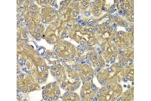 Immunohistochemistry of paraffin-embedded Rat kidney using PSMD5 Polyclonal Antibody at dilution of 1:100 (40x lens). (PSMD5 抗体)