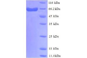 SDS-PAGE (SDS) image for delta Like Protein 3 (DLL3) (AA 27-492), (Extracellular) protein (His-SUMO Tag) (ABIN5711895)
