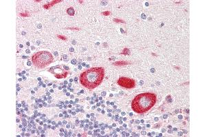 Immunohistochemistry (IHC) image for anti-MOB1, Mps One Binder Kinase Activator-Like 1B (MOBKL1B) (AA 167-216) antibody (ABIN6755362)