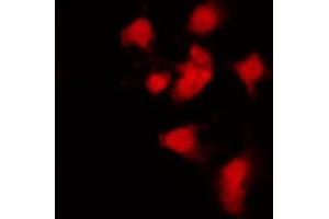 ABIN6269060 staining K562 by IF/ICC. (JAK2 抗体  (C-Term))