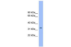 SLC25A1 antibody used at 1 ug/ml to detect target protein. (Slc25a1 抗体)