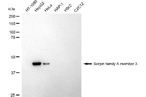 Western blotting analysis using Serpin family A member 3 antibody (ABIN7800317).
