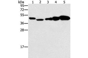 Western Blot analysis of Hela, Raji, Jurkat, A549 and NIH/3T3 cell using PPAT Polyclonal Antibody at dilution of 1:250 (PPAT 抗体)