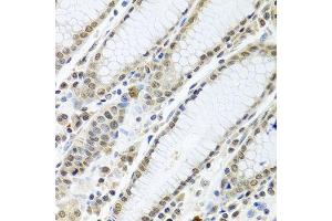 Immunohistochemistry of paraffin-embedded human stomach using TIA1 antibody at dilution of 1:100 (40x lens). (TIA1 抗体)