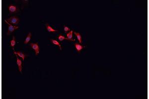 Immunofluorescence (fixed cells) (IF/ICC) image for anti-Mannose Receptor, C Type 2 (MRC2) (N-Term) antibody (ABIN6263346)