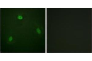Immunofluorescence analysis of NIH-3T3 cells, using Pin1 (Ab-1619) Antibody. (PIN1 抗体  (AA 1-50))