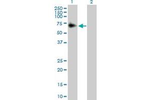 Western Blot analysis of ACP2 expression in transfected 293T cell line by ACP2 MaxPab polyclonal antibody. (ACP2 抗体  (AA 1-423))