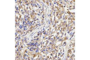 Immunohistochemistry (IHC) image for anti-Kinesin Light Chain 1 (KLC1) antibody (ABIN1876732) (KLC1 抗体)