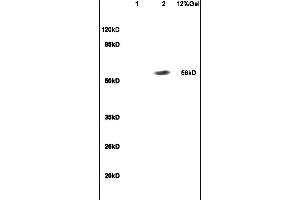 SDS-PAGE (SDS) image for anti-Recombination Signal Binding Protein For Immunoglobulin kappa J Region (RBPJ) (AA 101-200) antibody (ABIN872972)