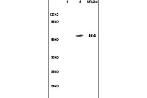 Lane 1: mouse embryo lysates Lane 2: human colon carcinoma lysates probed with Anti RBPJK/RBP-J Polyclonal Antibody, Unconjugated (ABIN872972) at 1:200 in 4C. (RBPJ 抗体  (AA 101-200))