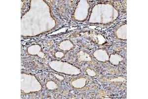 IHC analysis of Annexin VI/ANXA6 using anti-Annexin VI/ANXA6 antibody (ABIN5692982).