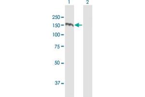 Western Blotting (WB) image for anti-TBC1 (Tre-2/USP6, BUB2, Cdc16) Domain Family, Member 1 (TBC1D1) (AA 1-1168) antibody (ABIN525034)