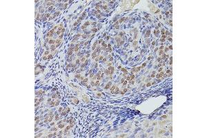 Immunohistochemistry (IHC) image for anti-Tet Methylcytosine Dioxygenase 3 (TET3) (AA 1525-1660) antibody (ABIN6149021)