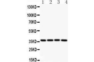Western Blotting (WB) image for anti-Induced Myeloid Leukemia Cell Differentiation Protein Mcl-1 (MCL1) (AA 1-350) antibody (ABIN3043876)