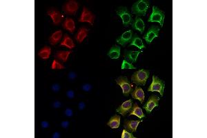 ABIN6258272 and ABIN6274405 staining Hela by IF/ICC. (MARK2 抗体  (Internal Region))