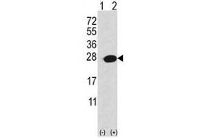 Image no. 1 for anti-Adenine Phosphoribosyltransferase (APRT) (C-Term) antibody (ABIN452752) (APRT 抗体  (C-Term))