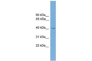 WB Suggested Anti-ZNF367 Antibody Titration:  0.