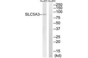Western blot analysis of extracts from HuvEc cells, using SLC5A3 Antibody. (SLC5A3 抗体  (AA 221-270))