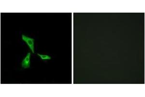 Immunofluorescence analysis of HeLa cells, using GPR101 Antibody. (GPR101 抗体  (AA 451-500))