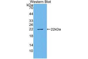 Western blot analysis of recombinant Human EREG.