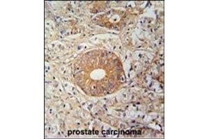 Immunohistochemistry (Paraffin-embedded Sections) (IHC (p)) image for anti-Solute Carrier Family 35, Member E2 (SLC35E2) (AA 1-30), (N-Term) antibody (ABIN954823)