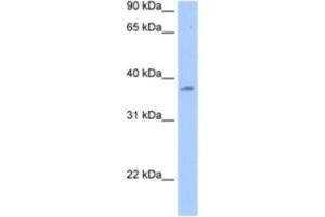 Western Blotting (WB) image for anti-RNA Binding Motif Protein, Y-Linked Family 1 Member A1 (RBMY1A1) antibody (ABIN2462072)