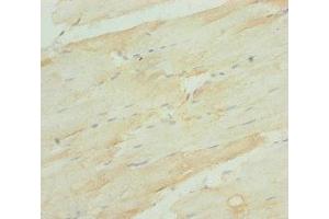 Immunohistochemistry of paraffin-embedded human skeletal muscle tissue using ABIN7168273 at dilution of 1:100 (A2BP1 抗体  (AA 1-130))