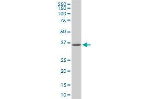 SPP1 monoclonal antibody (M05), clone 1F5. (Osteopontin 抗体  (AA 1-300))