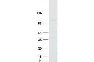 Western Blotting (WB) image for Zinc Finger Protein 238 (ZNF238) (Transcript Variant 1) protein (Myc-DYKDDDDK Tag) (ABIN2735971)
