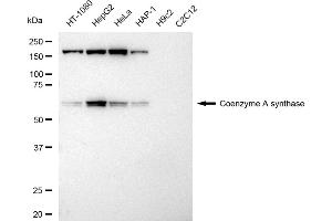 Western blotting analysis using Coenzyme A synthase antibody (ABIN7798104). (Recombinant COASY 抗体)