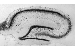 Adult rat hippocampus immunohistochemistry.