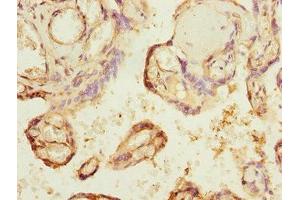 Immunohistochemistry of paraffin-embedded human placenta tissue using ABIN7147657 at dilution of 1:100 (GCM1 抗体  (AA 207-436))