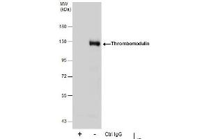 IP Image Immunoprecipitation of Thrombomodulin protein from THP-1 whole cell extracts using 5 μg of Thrombomodulin antibody [C3], C-term, Western blot analysis was performed using Thrombomodulin antibody [C3], C-term, EasyBlot anti-Rabbit IgG  was used as a secondary reagent. (Thrombomodulin 抗体  (C-Term))