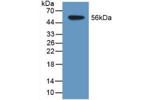 Detection of Recombinant TDH, Human using Polyclonal Antibody to L-Threonine Dehydrogenase (TDH) (Tdh 抗体  (AA 1-229))