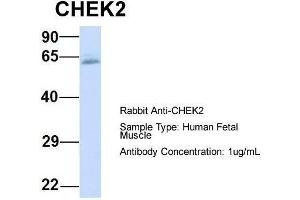 Host:  Rabbit  Target Name:  CHEK2  Sample Type:  Human Fetal Muscle  Antibody Dilution:  1. (CHEK2 抗体  (N-Term))